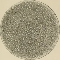 An illustration from Diseases of infancy and childhood, their dietetic, hygienic, and medical treatment : a text-book designed for practitioners and students in medicine / By Louis Fischer. (1910)
