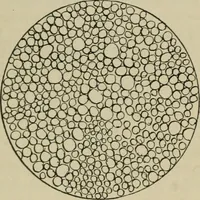 An illustration from Diseases of infancy and childhood, their dietetic, hygienic, and medical treatment : a text-book designed for practitioners and students in medicine / By Louis Fischer. (1910)