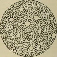 An illustration from Diseases of infancy and childhood, their dietetic, hygienic, and medical treatment : a text-book designed for practitioners and students in medicine / By Louis Fischer. (1910)