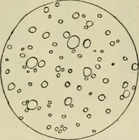 An illustration from Diseases of infancy and childhood, their dietetic, hygienic, and medical treatment : a text-book designed for practitioners and students in medicine / By Louis Fischer. (1910)