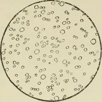 An illustration from Diseases of infancy and childhood, their dietetic, hygienic, and medical treatment : a text-book designed for practitioners and students in medicine / By Louis Fischer. (1910)