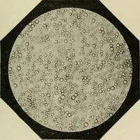 An illustration from Diseases of infancy and childhood, their dietetic, hygienic, and medical treatment : a text-book designed for practitioners and students in medicine / By Louis Fischer. (1910)