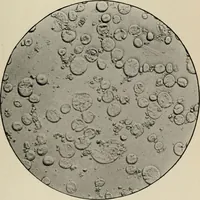 An illustration from Diseases of infancy and childhood, their dietetic, hygienic, and medical treatment : a text-book designed for practitioners and students in medicine / By Louis Fischer. (1910)