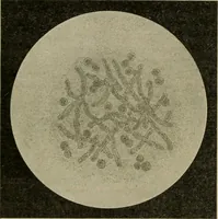 An illustration from Diseases of infancy and childhood, their dietetic, hygienic, and medical treatment : a text-book designed for practitioners and students in medicine / By Louis Fischer. (1910)