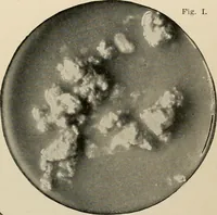 An illustration from Diseases of infancy and childhood, their dietetic, hygienic, and medical treatment : a text-book designed for practitioners and students in medicine / By Louis Fischer. (1910)