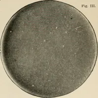 An illustration from Diseases of infancy and childhood, their dietetic, hygienic, and medical treatment : a text-book designed for practitioners and students in medicine / By Louis Fischer. (1910)
