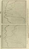 An illustration from Diseases of infancy and childhood, their dietetic, hygienic, and medical treatment : a text-book designed for practitioners and students in medicine / By Louis Fischer. (1910)