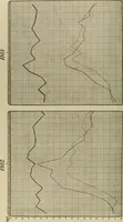 An illustration from Diseases of infancy and childhood, their dietetic, hygienic, and medical treatment : a text-book designed for practitioners and students in medicine / By Louis Fischer. (1910)