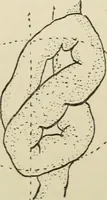 An illustration from Diseases of infancy and childhood, their dietetic, hygienic, and medical treatment : a text-book designed for practitioners and students in medicine / By Louis Fischer. (1910)