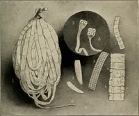 An illustration from Diseases of infancy and childhood, their dietetic, hygienic, and medical treatment : a text-book designed for practitioners and students in medicine / By Louis Fischer. (1910)