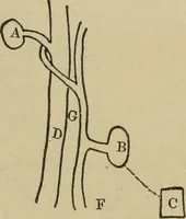 An illustration from Diseases of infancy and childhood, their dietetic, hygienic, and medical treatment : a text-book designed for practitioners and students in medicine / By Louis Fischer. (1910)