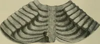 An illustration from Diseases of infancy and childhood, their dietetic, hygienic, and medical treatment : a text-book designed for practitioners and students in medicine / By Louis Fischer. (1910)