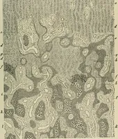 An illustration from Diseases of infancy and childhood, their dietetic, hygienic, and medical treatment : a text-book designed for practitioners and students in medicine / By Louis Fischer. (1910)