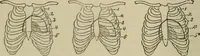 An illustration from Diseases of infancy and childhood, their dietetic, hygienic, and medical treatment : a text-book designed for practitioners and students in medicine / By Louis Fischer. (1910)