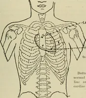 An illustration from Diseases of infancy and childhood, their dietetic, hygienic, and medical treatment : a text-book designed for practitioners and students in medicine / By Louis Fischer. (1910)