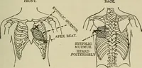 An illustration from Diseases of infancy and childhood, their dietetic, hygienic, and medical treatment : a text-book designed for practitioners and students in medicine / By Louis Fischer. (1910)