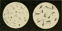 An illustration from Diseases of infancy and childhood, their dietetic, hygienic, and medical treatment : a text-book designed for practitioners and students in medicine / By Louis Fischer. (1910)