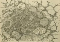 An illustration from Diseases of infancy and childhood, their dietetic, hygienic, and medical treatment : a text-book designed for practitioners and students in medicine / By Louis Fischer. (1910)