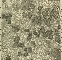 An illustration from Diseases of infancy and childhood, their dietetic, hygienic, and medical treatment : a text-book designed for practitioners and students in medicine / By Louis Fischer. (1910)