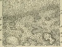 An illustration from Diseases of infancy and childhood, their dietetic, hygienic, and medical treatment : a text-book designed for practitioners and students in medicine / By Louis Fischer. (1910)