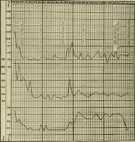 An illustration from Diseases of infancy and childhood, their dietetic, hygienic, and medical treatment : a text-book designed for practitioners and students in medicine / By Louis Fischer. (1910)