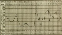 An illustration from Diseases of infancy and childhood, their dietetic, hygienic, and medical treatment : a text-book designed for practitioners and students in medicine / By Louis Fischer. (1910)