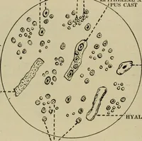 An illustration from Diseases of infancy and childhood, their dietetic, hygienic, and medical treatment : a text-book designed for practitioners and students in medicine / By Louis Fischer. (1910)