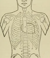 An illustration from Diseases of infancy and childhood, their dietetic, hygienic, and medical treatment : a text-book designed for practitioners and students in medicine / By Louis Fischer. (1910)