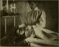 An illustration from Diseases of infancy and childhood, their dietetic, hygienic, and medical treatment : a text-book designed for practitioners and students in medicine / By Louis Fischer. (1910)