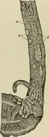 An illustration from Diseases of infancy and childhood, their dietetic, hygienic, and medical treatment : a text-book designed for practitioners and students in medicine / By Louis Fischer. (1910)