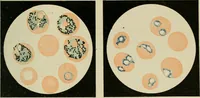 An illustration from Diseases of infancy and childhood, their dietetic, hygienic, and medical treatment : a text-book designed for practitioners and students in medicine / By Louis Fischer. (1910)
