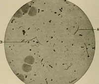 An illustration from Diseases of infancy and childhood, their dietetic, hygienic, and medical treatment : a text-book designed for practitioners and students in medicine / By Louis Fischer. (1910)