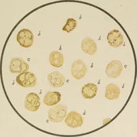 An illustration from Diseases of infancy and childhood, their dietetic, hygienic, and medical treatment : a text-book designed for practitioners and students in medicine / By Louis Fischer. (1910)