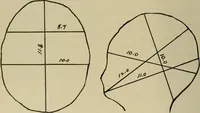 An illustration from Diseases of infancy and childhood, their dietetic, hygienic, and medical treatment : a text-book designed for practitioners and students in medicine / By Louis Fischer. (1910)