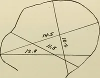 An illustration from Diseases of infancy and childhood, their dietetic, hygienic, and medical treatment : a text-book designed for practitioners and students in medicine / By Louis Fischer. (1910)