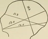 An illustration from Diseases of infancy and childhood, their dietetic, hygienic, and medical treatment : a text-book designed for practitioners and students in medicine / By Louis Fischer. (1910)