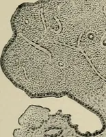 An illustration from Diseases of infancy and childhood, their dietetic, hygienic, and medical treatment : a text-book designed for practitioners and students in medicine / By Louis Fischer. (1910)