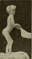 An illustration from Diseases of infancy and childhood, their dietetic, hygienic, and medical treatment : a text-book designed for practitioners and students in medicine / By Louis Fischer. (1910)