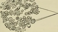 An illustration from Diseases of infancy and childhood, their dietetic, hygienic, and medical treatment : a text-book designed for practitioners and students in medicine / By Louis Fischer. (1910)
