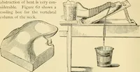 An illustration from Surgical technic; a text-book on operative surgery / by Fr. von Esmarch ... and E. Kowalzig ... translated by Professor Ludwig H. Grau ... and Willam N. Sullivan ... edited by Nicholas Senn ... With fourteen hundred and ninety-seven illustrations and fifteen colored plates. (1901)