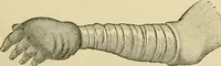 An illustration from Surgical technic; a text-book on operative surgery / by Fr. von Esmarch ... and E. Kowalzig ... translated by Professor Ludwig H. Grau ... and Willam N. Sullivan ... edited by Nicholas Senn ... With fourteen hundred and ninety-seven illustrations and fifteen colored plates. (1901)