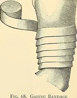 An illustration from Surgical technic; a text-book on operative surgery / by Fr. von Esmarch ... and E. Kowalzig ... translated by Professor Ludwig H. Grau ... and Willam N. Sullivan ... edited by Nicholas Senn ... With fourteen hundred and ninety-seven illustrations and fifteen colored plates. (1901)