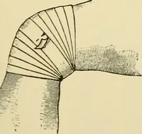 An illustration from Surgical technic; a text-book on operative surgery / by Fr. von Esmarch ... and E. Kowalzig ... translated by Professor Ludwig H. Grau ... and Willam N. Sullivan ... edited by Nicholas Senn ... With fourteen hundred and ninety-seven illustrations and fifteen colored plates. (1901)