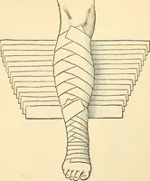 An illustration from Surgical technic; a text-book on operative surgery / by Fr. von Esmarch ... and E. Kowalzig ... translated by Professor Ludwig H. Grau ... and Willam N. Sullivan ... edited by Nicholas Senn ... With fourteen hundred and ninety-seven illustrations and fifteen colored plates. (1901)