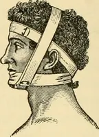 An illustration from Surgical technic; a text-book on operative surgery / by Fr. von Esmarch ... and E. Kowalzig ... translated by Professor Ludwig H. Grau ... and Willam N. Sullivan ... edited by Nicholas Senn ... With fourteen hundred and ninety-seven illustrations and fifteen colored plates. (1901)
