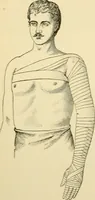 An illustration from Surgical technic; a text-book on operative surgery / by Fr. von Esmarch ... and E. Kowalzig ... translated by Professor Ludwig H. Grau ... and Willam N. Sullivan ... edited by Nicholas Senn ... With fourteen hundred and ninety-seven illustrations and fifteen colored plates. (1901)