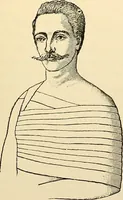 An illustration from Surgical technic; a text-book on operative surgery / by Fr. von Esmarch ... and E. Kowalzig ... translated by Professor Ludwig H. Grau ... and Willam N. Sullivan ... edited by Nicholas Senn ... With fourteen hundred and ninety-seven illustrations and fifteen colored plates. (1901)