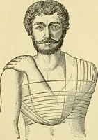 An illustration from Surgical technic; a text-book on operative surgery / by Fr. von Esmarch ... and E. Kowalzig ... translated by Professor Ludwig H. Grau ... and Willam N. Sullivan ... edited by Nicholas Senn ... With fourteen hundred and ninety-seven illustrations and fifteen colored plates. (1901)