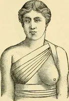 An illustration from Surgical technic; a text-book on operative surgery / by Fr. von Esmarch ... and E. Kowalzig ... translated by Professor Ludwig H. Grau ... and Willam N. Sullivan ... edited by Nicholas Senn ... With fourteen hundred and ninety-seven illustrations and fifteen colored plates. (1901)