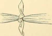 An illustration from Surgical technic; a text-book on operative surgery / by Fr. von Esmarch ... and E. Kowalzig ... translated by Professor Ludwig H. Grau ... and Willam N. Sullivan ... edited by Nicholas Senn ... With fourteen hundred and ninety-seven illustrations and fifteen colored plates. (1901)